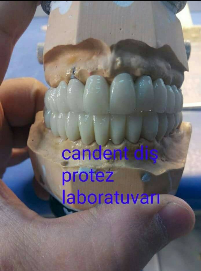 Candent Diş Protez